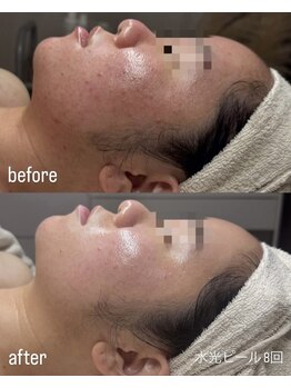 フロル(FLOR)/FLOR【根本改善専門店】