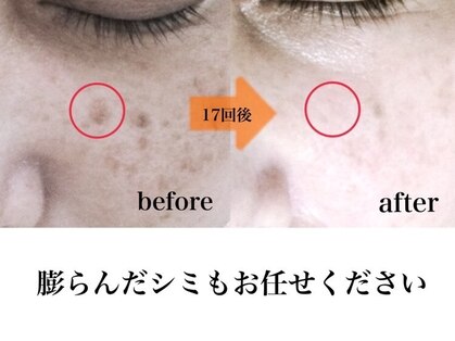 パルサロン(palsalon.)の写真