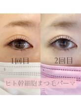 アイビューティー(AI beauty)/ヒト幹細胞まつげパーマ