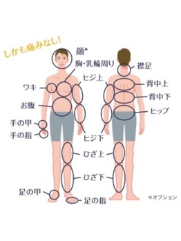 オリオンドットエスツー(Orion.S2)/【メンズも部位別脱毛可能☆】