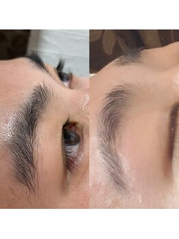 アルテ ベップ(arte BEPPU)/