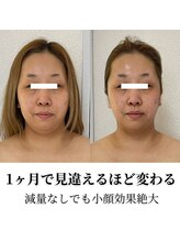 シファ(SHIFA)/小顔はつくれる