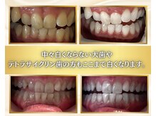 エランホワイトニング 一社店の雰囲気（どこに行っても白くならなかった方必見☆歯科提携ホワイトニング）