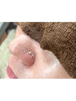 毛穴ケアをしたい