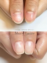 マリーロール 淀屋橋本店(Marie Laure)/自爪育成/深爪矯正/ネイルケア
