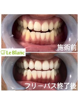 ルブラン 奈良店(Le Blanc)/男性のお客様!