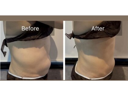 ニコリ(NICOLI)の写真