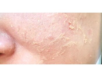 パウザ(PAUSA)/剥離も目に見える満足度の一つ！