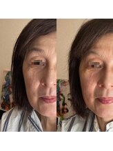 ミーティット(Meetite)/プラズマがオススメ