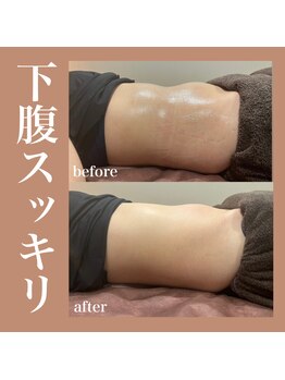 フラットベリー 恵比寿(Flat BELLY)/究極のお腹集中ケア120分コース