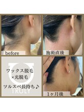 トゥルーリー(TRULY)/《うなじワックス》