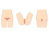 【回数券】☆女性用☆VIO脱毛×8回券 36000→33000◇最新 SHR脱毛×IPL脱毛◇