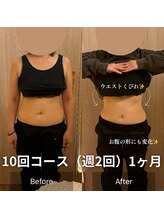 ウナ サロン ド グッドスタイル(UNA SALON DE GOOD STYLE)/エムスレンダー(電磁波痩身)