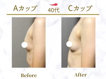 Ms.やまとなでしこ/ビフォーアフター