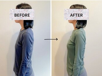 ラーナビコツ(RANA-bikotsu)/トータル矯正コース利用のお客様