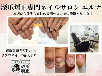 エルナ(elna)の写真