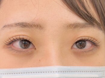 インミニネイルサロン 上野御徒町(INMENE)/