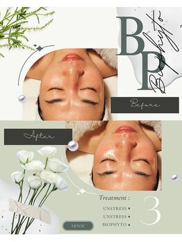 ハレル(Hareru)/Before…After(7)　BIOPHYTO