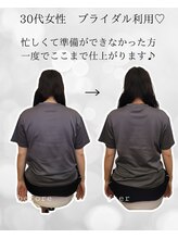 シナジェ 並木通り店(Synergye)/美小顔美姿勢には背中重要！