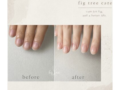 フィグ ツリー(fig tree)の写真