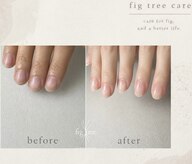 フィグ ツリー(fig tree)