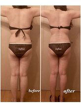 アンフィニ(infini)/短期集中コース5回（1.5ヶ月）