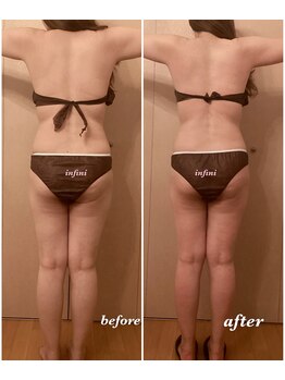 アンフィニ(infini)/短期集中コース5回(1.5ヶ月)