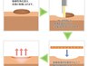 【イボケア】首やお顔の茶色の凸ケアに♪　取り放題　15分