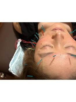 小顔になりたい