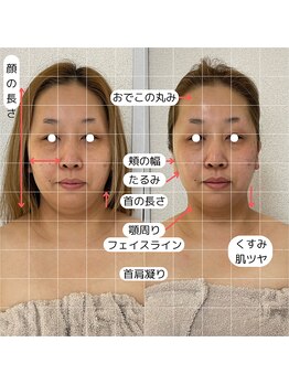 シファ(SHIFA)/効果を感じたい方