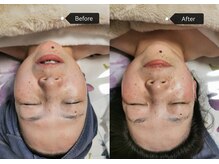 シークレット(Secret)/小顔、ヘッド