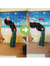 サプライズ整体院/40代ママさんの腰痛初回結果