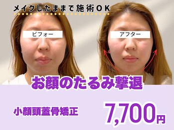 ミンティー 三宮店の写真/仕事帰りメイクしたまま小顔矯正を体験！頭蓋骨矯正でお顔のたるみケアをサポート☆