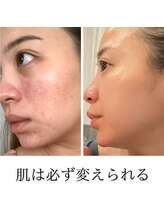 シファ(SHIFA)/変わらない肌はない