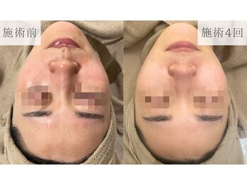 リーフィア(Leafia)/【長年の肌トラブルも改善◎】