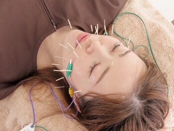 こころ晴れ鍼灸院の写真/《歴25年の整骨・鍼灸師による小顔施術》リピータ―満足度も◎引き締まったフェイスラインでハリ艶美肌に☆