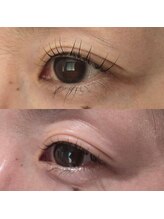 ソラ(SORA)/ラッシュアディクトの効果