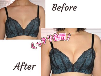 バストサロン メルベイユ(Merveile)の写真/全身にアプローチする独自バストアップメソッド!二の腕や背中のお肉をバストに&ウエストくびれもGET