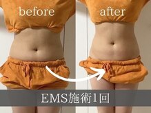 寝てるだけで筋トレ！30分で2万回の筋トレ効果を実現！