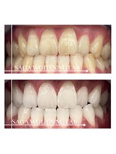 佐賀ホワイトニングラボ/