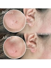 サロンロン 横浜関内(SALON RON)/