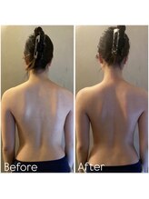 エステプリヴェモロッコ(ESTHE PRIVE MOROCCO)/カッサ×リンパマッサージ