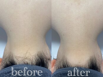 マドンナリリー 恵比寿店(Madonna Lily)/うなじ