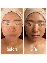 ディグニータココ 自由が丘(DIGNITA coco)/☆before after☆