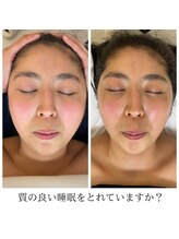 シファ(SHIFA)/頭痛にお悩みの方