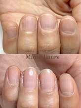 マリーロール 梅田店(Marie Laure)/深爪矯正/自爪育成/自爪風