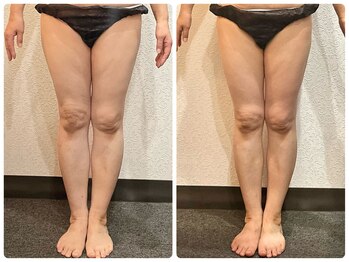 美容整体ウェリナ 名駅院/小顔矯正/骨盤矯正/美脚サロン