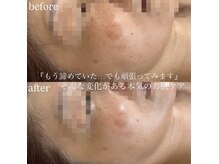 ビューティーサロン プティ(beauty salon petite)の雰囲気（フェイシャル/マタニティ/シミしわケア/レモンボトル/ピーリング）