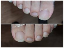 爪切り屋 足楽/【フットケア】足の爪切り