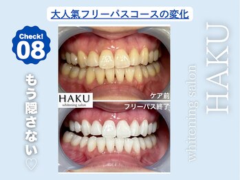 ハク 袋井磐田店(HAKU)/お客様before→after 8